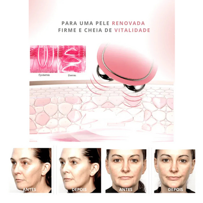 Massageador de Lifting Facial
