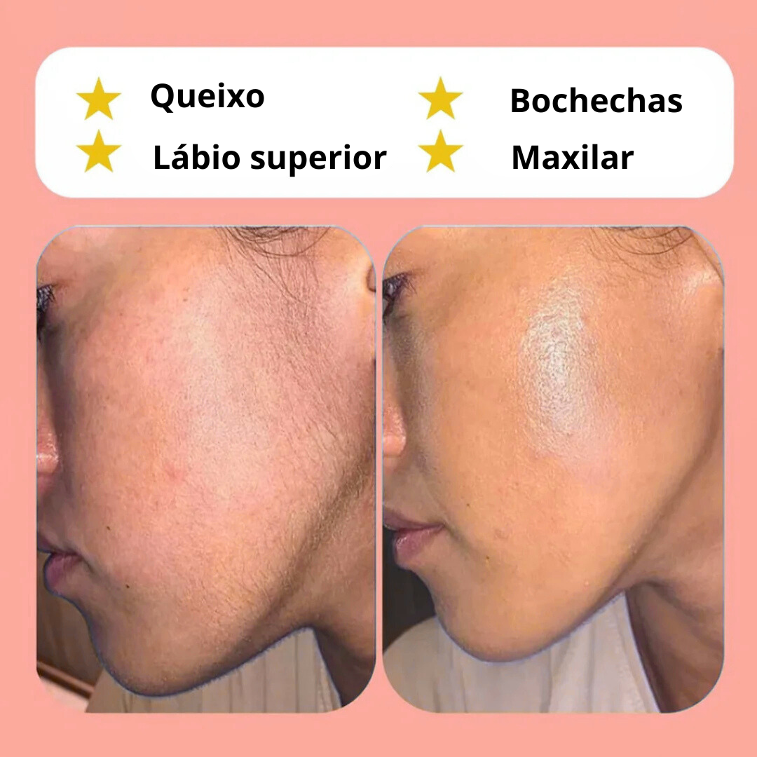 Zanolos - Depilador facial